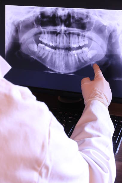 Best Emergency Dental Care for Broken or Chipped Teeth in Covington, LA