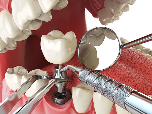 Best Weekend Emergency Dentist in Covington, LA